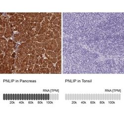 Pancreatic Lipase Antibody, Novus Biologicals 0.1mL; Unlabeled:Antibodies,